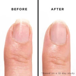 Bramley Apple Jelly Preserve Strengthening Treatment 12 Bramley Apple Jelly Preserve Strengthening Treatment -Skinora Store bramley apple jelly preserve strengthening treatmentnail treatment 625787