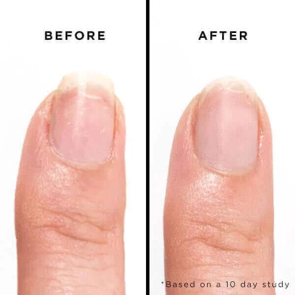 Bramley Apple Jelly Preserve Strengthening Treatment 6 Bramley Apple Jelly Preserve Strengthening Treatment - Image 4