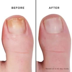 Fashion Size Mellow The Yellow Nail Brightening Treatment -Skinora Store mini mellow the yellow nail brightening treatment 488829