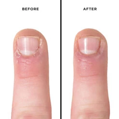 Quick Slip Cuticle Oil 11 Quick Slip Cuticle Oil -Skinora Store quick slip cuticle oil 887120