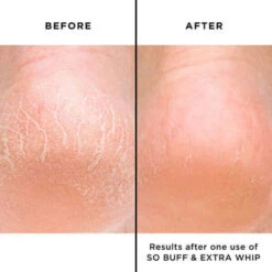 So Buff -Skinora Store so buff 152428