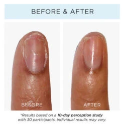 Strawberry Rhubarb Jelly Preserve Strengthening Treatment -Skinora Store strawberry rhubarb jelly preserve strengthening treatment 332140